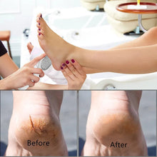 Charger l'image dans la galerie, Super outils d'exfoliation des pieds